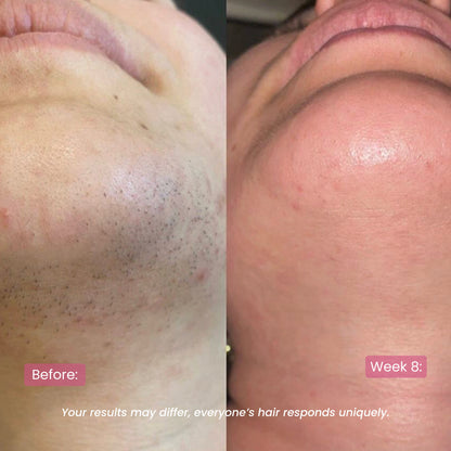 CyperRitual™ - Cyperus Rotundus Facial Oil