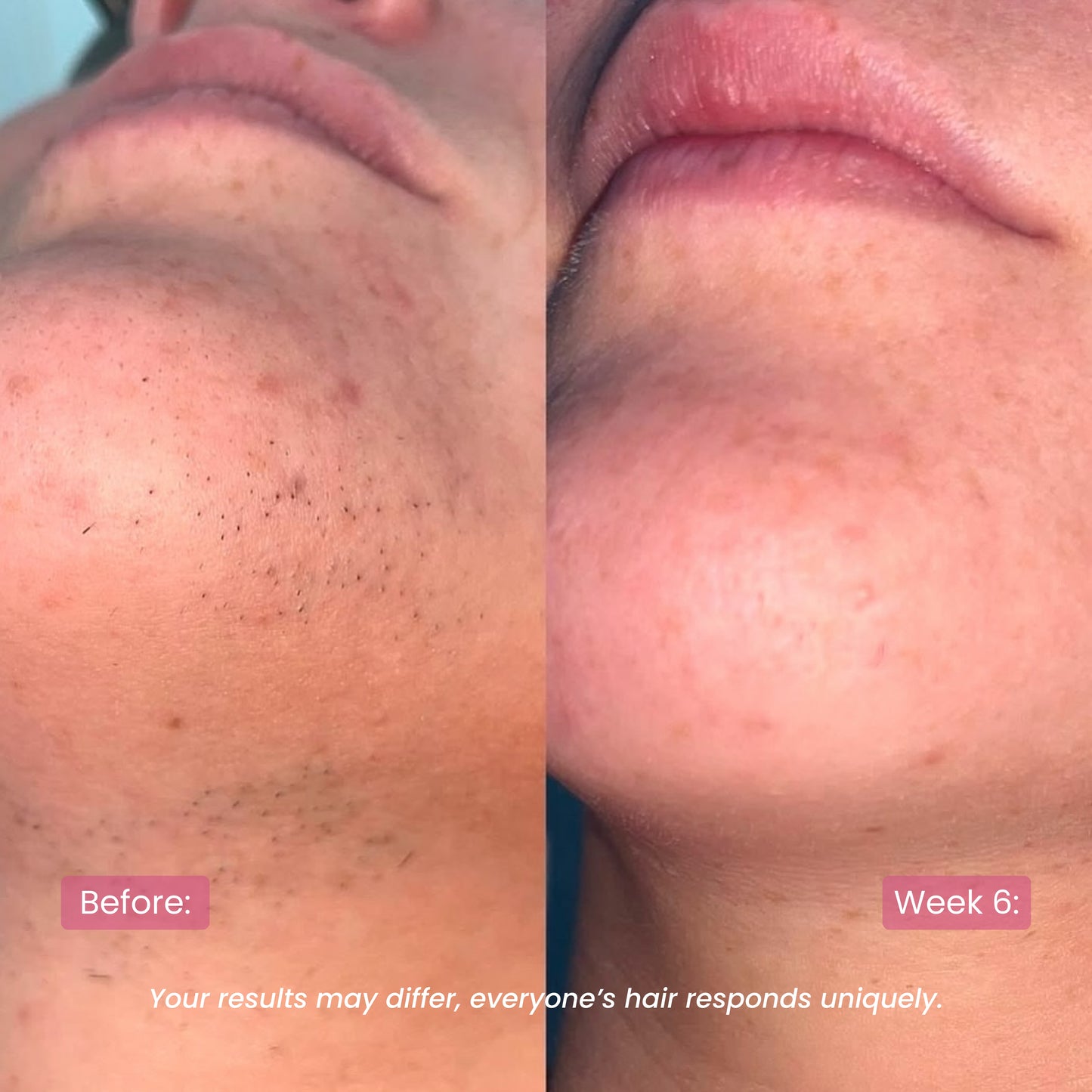 CyperRitual™ - Cyperus Rotundus Facial Oil