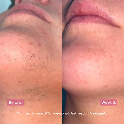 CyperRitual™ - Cyperus Rotundus Facial Oil