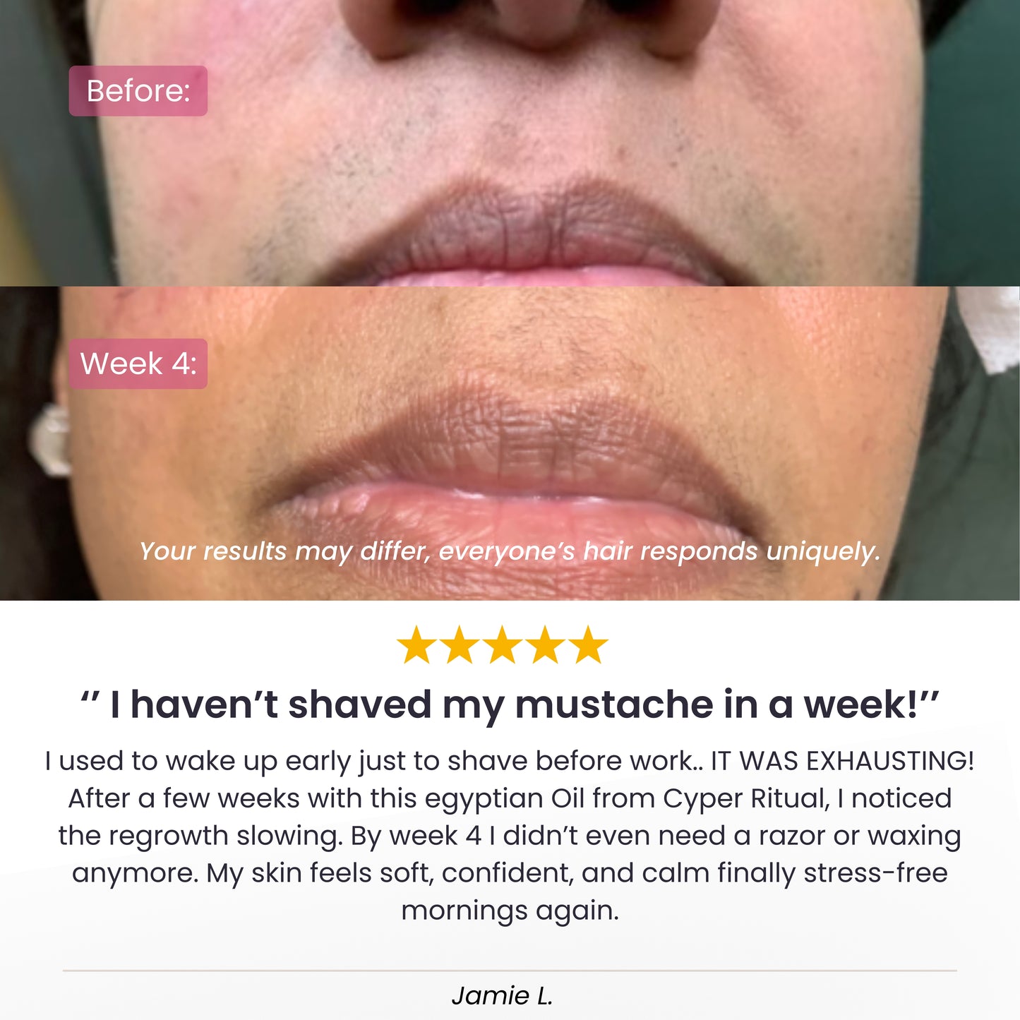 CyperRitual™ - Cyperus Rotundus Facial Oil