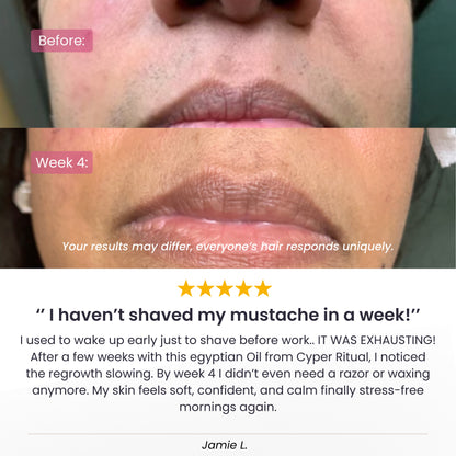 CyperRitual™ - Cyperus Rotundus Facial Oil
